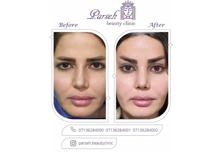 کلینیک تخصصی پوست مو و زیبایی نهال - تصویر 2